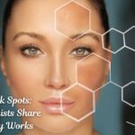 Fading Dark Spots Dermatologists Share What Really Works