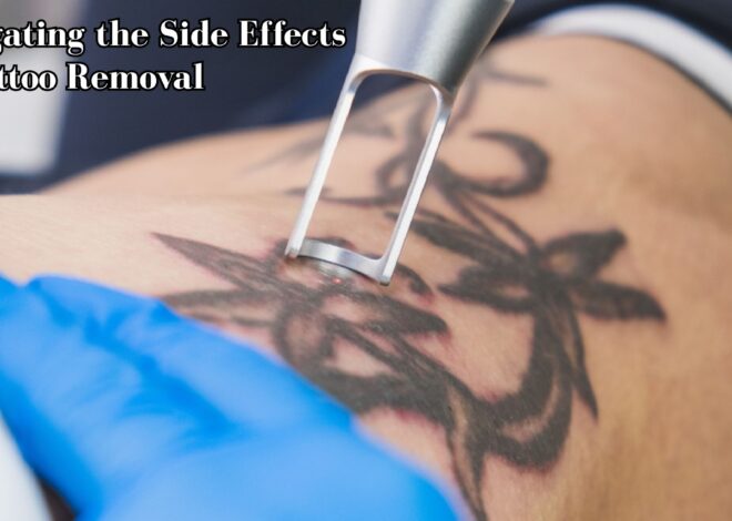 Navigating the Side Effects of Tattoo Removal